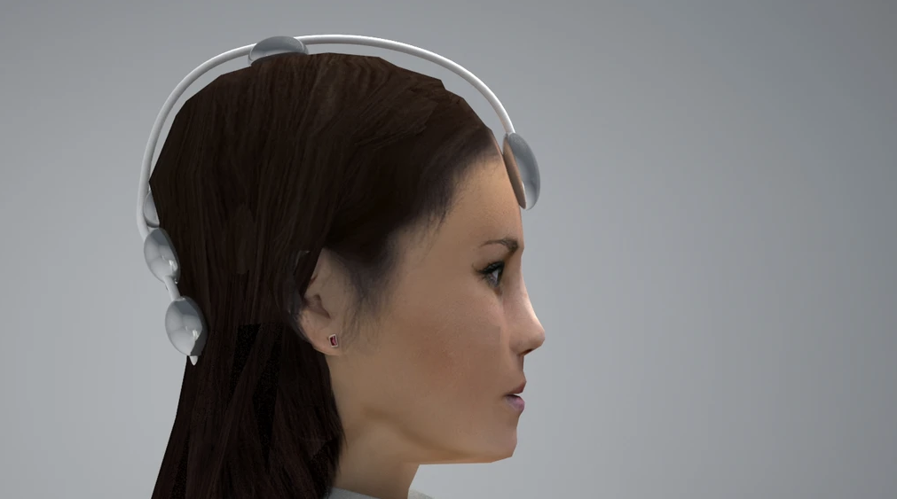 片麻痺上肢リハビリ用BMI（Brain-machine Interface）アシストスーツ — 3